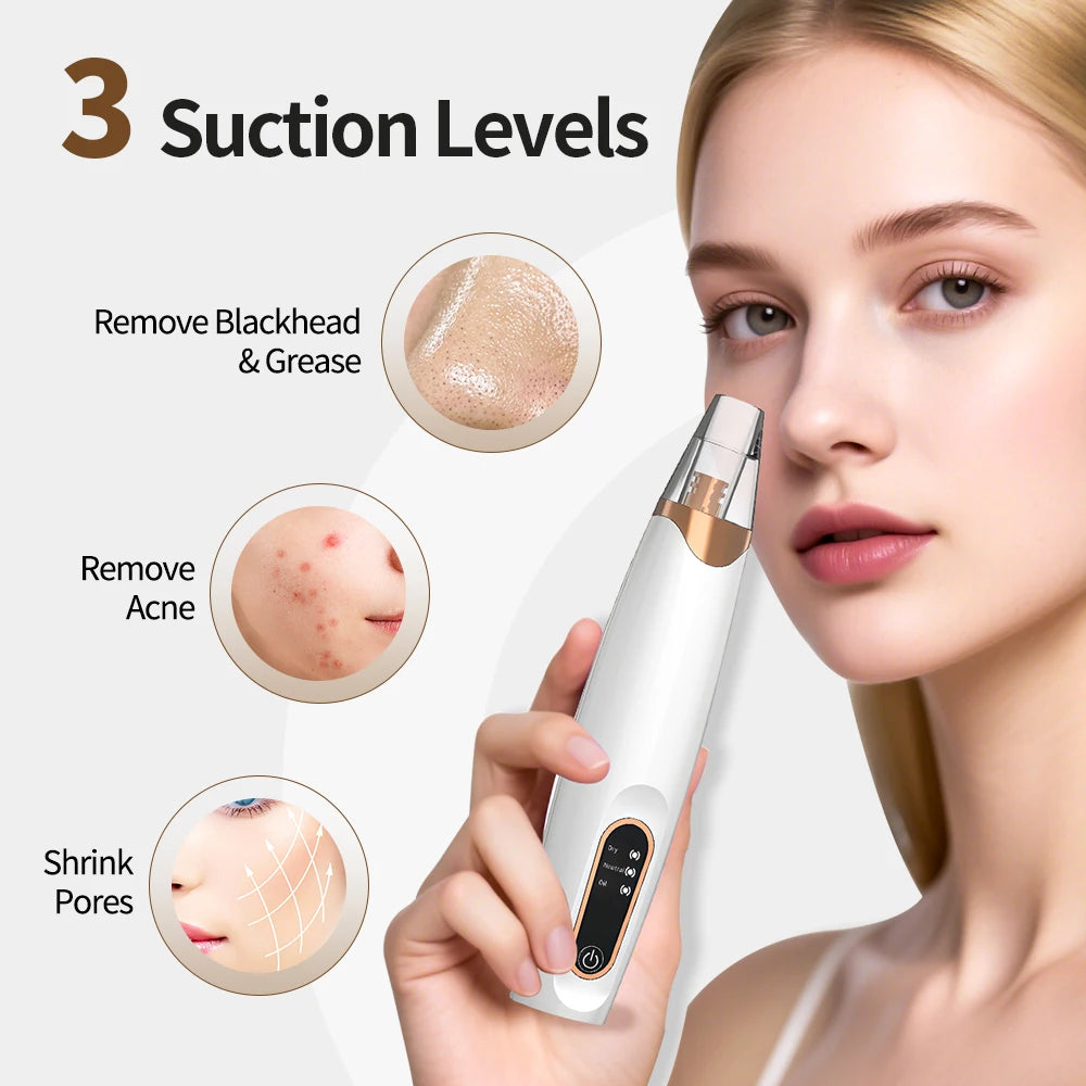 Electric Blackhead Remover Vacuum Cleaner Black Spots Removal Facial Deep Cleansing Pore Cleaner Machine Face Skin Care Tools