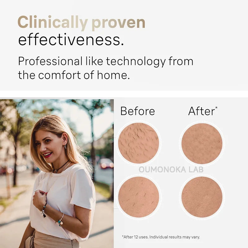 999999 Flashes IPL Laser Epilator for Women Home Use Devices Hair Removal Painless Electric Epilator Bikini