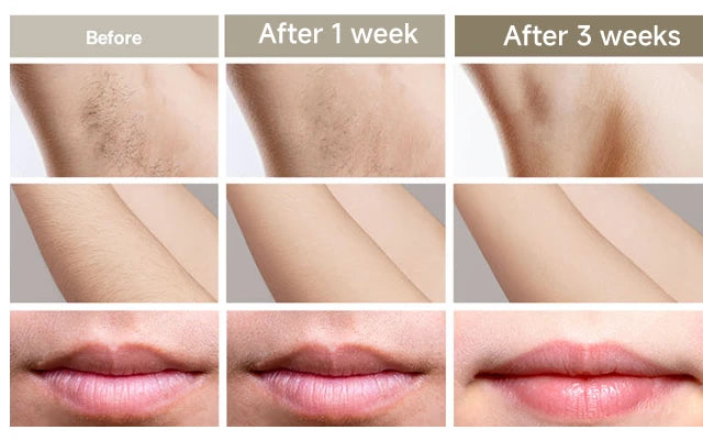 999999 Flashes IPL Laser Epilator for Women Home Use Devices Hair Removal Painless Electric Epilator Bikini